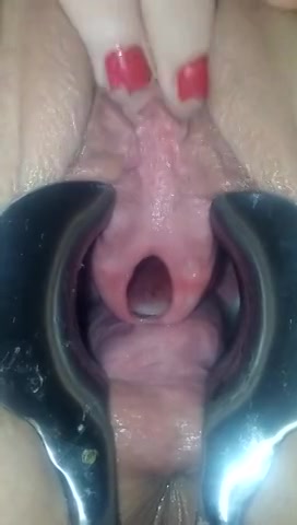 PLaatje van Wat komt daar uit haar urinebuis